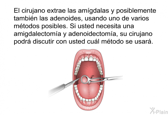 El cirujano extrae las am�gdalas y posiblemente tambi�n las adenoides, usando uno de varios m�todos posibles. Si usted necesita una amigdalectom�a y adenoidectom�a, su cirujano podr� discutir con usted cu�l m�todo se usar�.