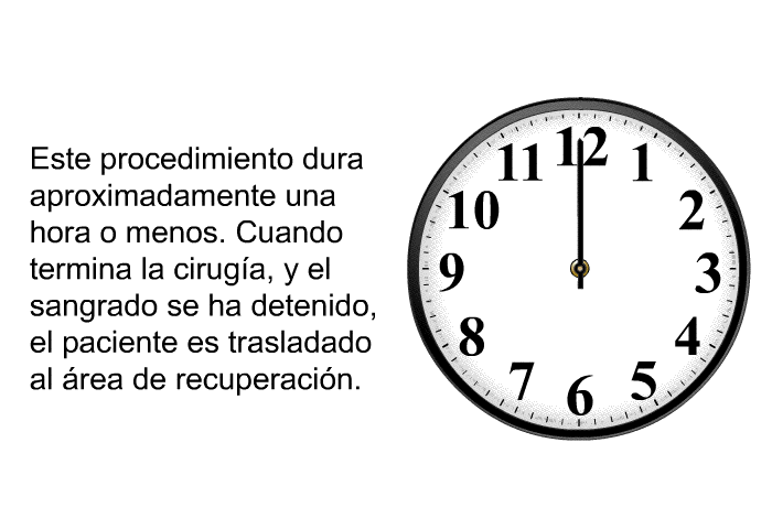 Este procedimiento dura aproximadamente una hora o menos. Cuando termina la cirug�a, y el sangrado se ha detenido, el paciente es trasladado al �rea de recuperaci�n.