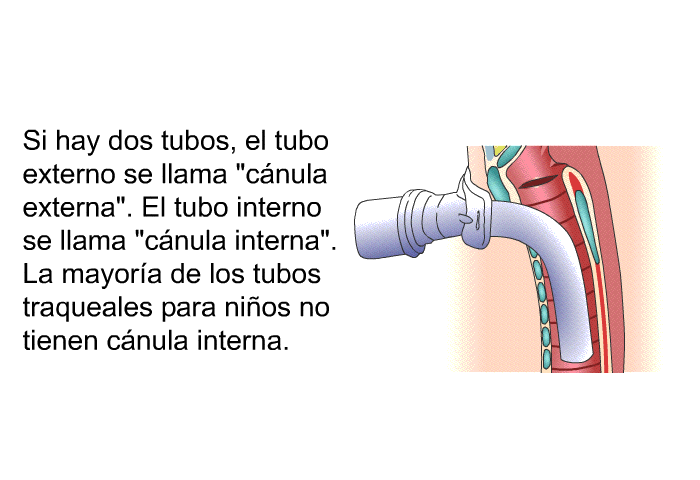 Si hay dos tubos, el tubo externo se llama “cnula externa”. El tubo interno se llama “cnula interna”. La mayora de los tubos traqueales para nios no tienen cnula interna.