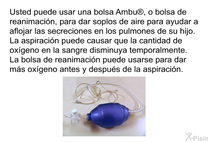 Usted puede usar una bolsa Ambu<SUP> </SUP>, o bolsa de reanimacin, para dar soplos de aire para ayudar a aflojar las secreciones en los pulmones de su hijo. La aspiracin puede causar que la cantidad de oxgeno en la sangre disminuya temporalmente. La bolsa de reanimacin puede usarse para dar ms oxgeno antes y despus de la aspiracin.