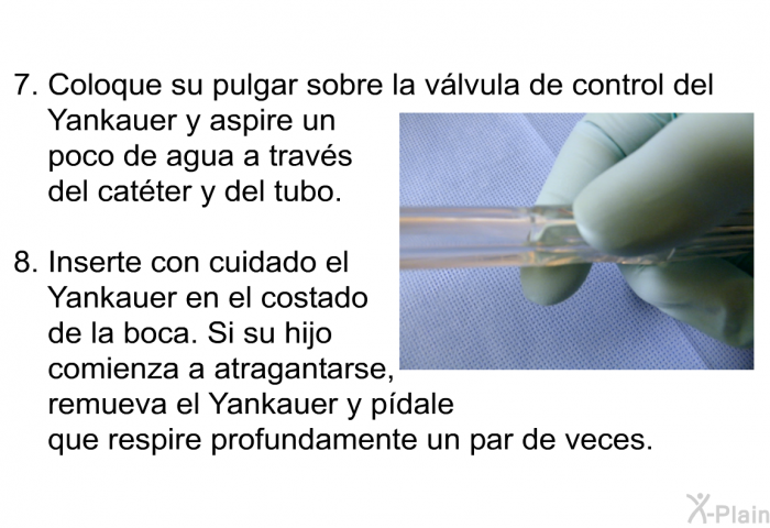 Coloque su pulgar sobre la v�lvula de control del Yankauer y aspire un poco de agua a trav�s del cat�ter y del tubo. Inserte con cuidado el Yankauer en el costado de la boca. Si su hijo comienza a atragantarse, remueva el Yankauer y p�dale que respire profundamente un par de veces.