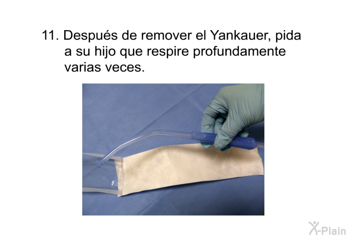 Despu�s de remover el Yankauer, pida a su hijo que respire profundamente varias veces.