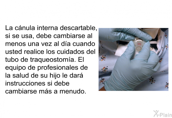 La c�nula interna descartable, si se usa, debe cambiarse al menos una vez al d�a cuando usted realice los cuidados del tubo de traqueostom�a. El equipo de profesionales de la salud de su hijo le dar� instrucciones si debe cambiarse m�s a menudo.