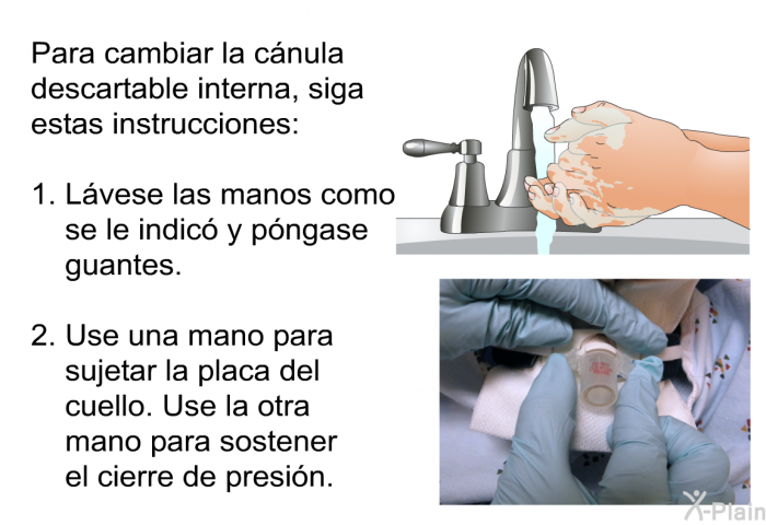 Para cambiar la c�nula descartable interna, siga estas instrucciones:  L�vese las manos como se le indic� y p�ngase guantes. Use una mano para sujetar la placa del cuello. Use la otra mano para sostener el cierre de presi�n.