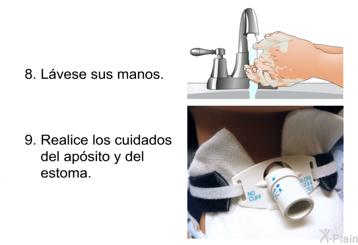 L�vese sus manos. Realice los cuidados del ap�sito y del estoma.