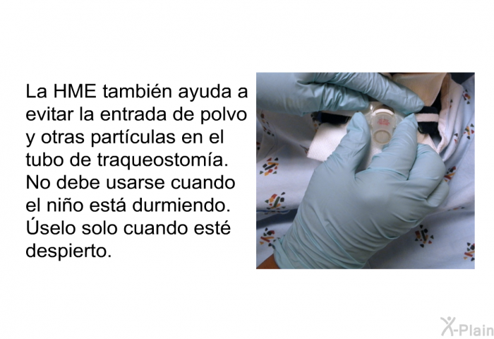 La HME tambin ayuda a evitar la entrada de polvo y otras partculas en el tubo de traqueostoma. No debe usarse cuando el nio est durmiendo. Úselo solo cuando est despierto.
