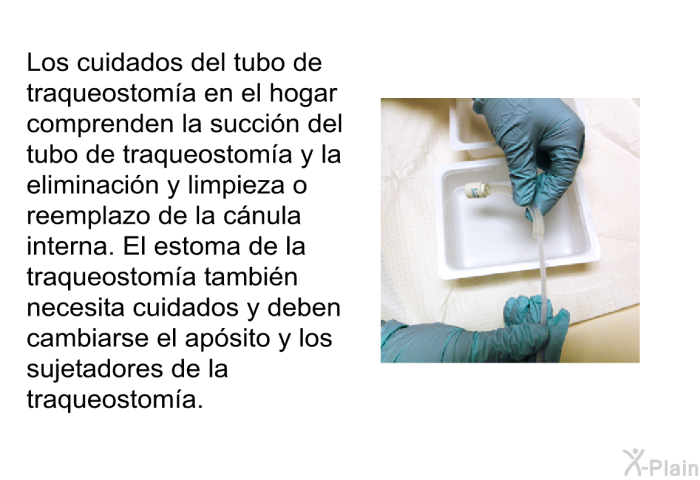 Los cuidados del tubo de traqueostom�a en el hogar comprenden la succi�n del tubo de traqueostom�a y la eliminaci�n y limpieza o reemplazo de la c�nula interna. El estoma de la traqueostom�a tambi�n necesita cuidados y deben cambiarse el ap�sito y los sujetadores de la traqueostom�a.