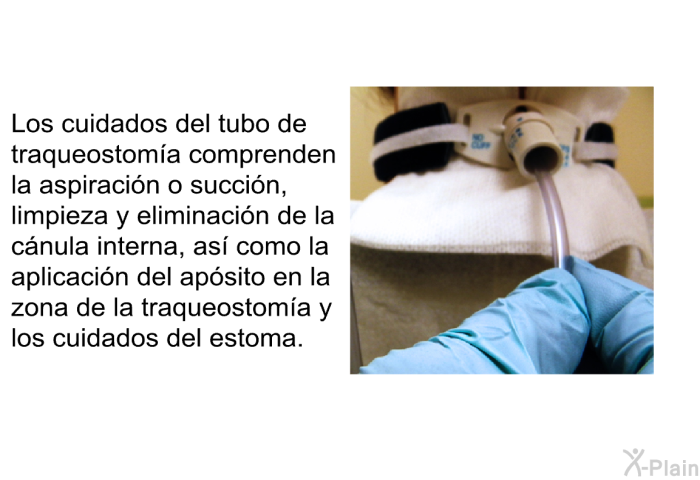 Los cuidados del tubo de traqueostoma comprenden la aspiracin o succin, limpieza y eliminacin de la cnula interna, as como la aplicacin del apsito en la zona de la traqueostoma y los cuidados del estoma.