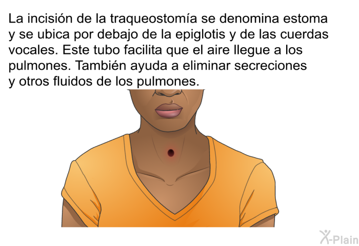 La incisin de la traqueostoma se denomina estoma y se ubica por debajo de la epiglotis y de las cuerdas vocales. Este tubo facilita que el aire llegue a los pulmones. Tambin ayuda a eliminar secreciones y otros fluidos de los pulmones.