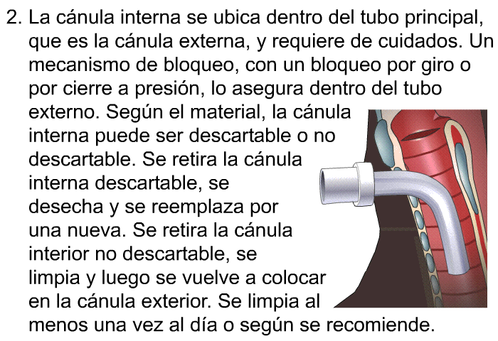 La c�nula interna se ubica dentro del tubo principal, que es la c�nula externa, y requiere de cuidados. Un mecanismo de bloqueo, con un bloqueo por giro o por cierre a presi�n, lo asegura dentro del tubo externo. Seg�n el material, la c�nula interna puede ser descartable o no descartable. Se retira la c�nula interna descartable, se desecha y se reemplaza por una nueva. Se retira la c�nula interior no descartable, se limpia y luego se vuelve a colocar en la c�nula exterior. Se limpia al menos una vez al d�a o seg�n se recomiende.