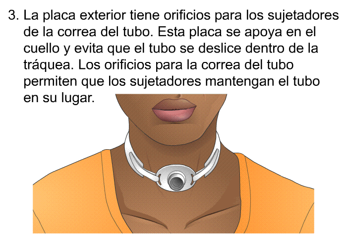 La placa exterior tiene orificios para los sujetadores de la correa del tubo. Esta placa se apoya en el cuello y evita que el tubo se deslice dentro de la tr�quea. Los orificios para la correa del tubo permiten que los sujetadores mantengan el tubo en su lugar.