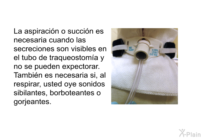 La aspiraci�n o succi�n es necesaria cuando las secreciones son visibles en el tubo de traqueostom�a y no se pueden expectorar. Tambi�n es necesaria si, al respirar, usted oye sonidos sibilantes, borboteantes o gorjeantes.