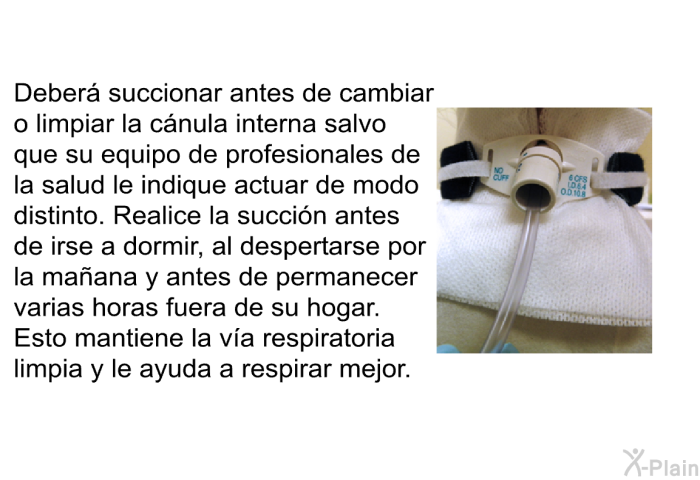 Deber� succionar antes de cambiar o limpiar la c�nula interna salvo que su equipo de profesionales de la salud le indique actuar de modo distinto. Realice la succi�n antes de irse a dormir, al despertarse por la ma�ana y antes de permanecer varias horas fuera de su hogar. Esto mantiene la v�a respiratoria limpia y le ayuda a respirar mejor.