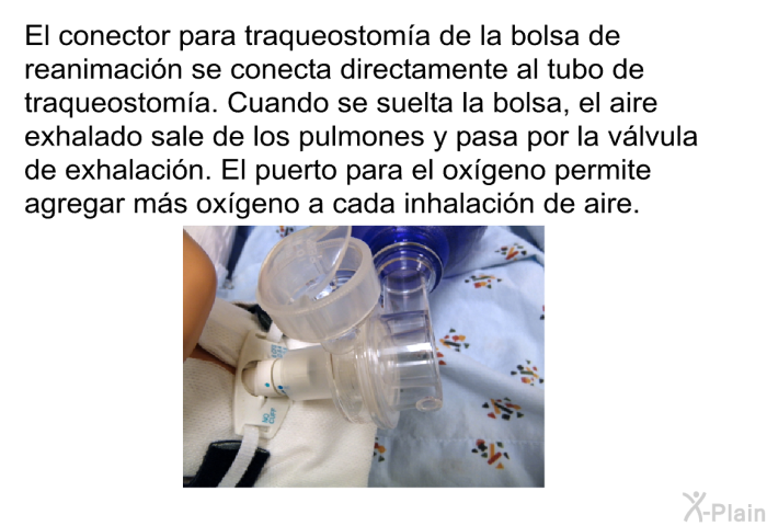 El conector para traqueostom�a de la bolsa de reanimaci�n se conecta directamente al tubo de traqueostom�a. Cuando se suelta la bolsa, el aire exhalado sale de los pulmones y pasa por la v�lvula de exhalaci�n. El puerto para el ox�geno permite agregar m�s ox�geno a cada inhalaci�n de aire.
