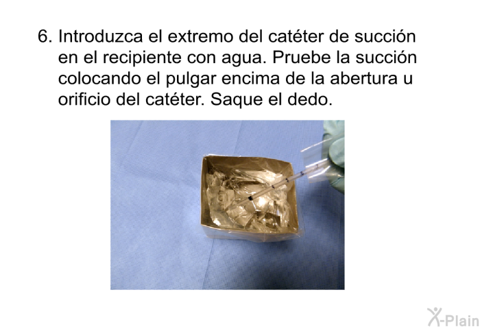 Introduzca el extremo del cat�ter de succi�n en el recipiente con agua. Pruebe la succi�n colocando el pulgar encima de la abertura u orificio del cat�ter. Saque el dedo.