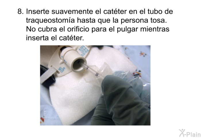Inserte suavemente el cat�ter en el tubo de traqueostom�a hasta que la persona tosa. No cubra el orificio para el pulgar mientras inserta el cat�ter.