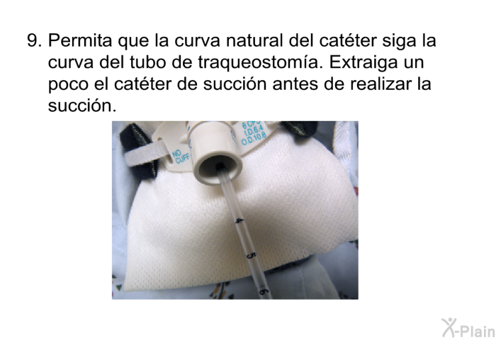 Permita que la curva natural del cat�ter siga la curva del tubo de traqueostom�a. Extraiga un poco el cat�ter de succi�n antes de realizar la succi�n.