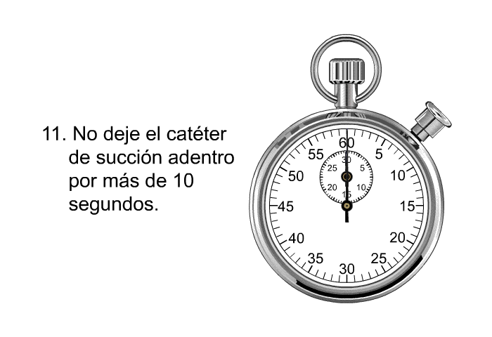 No deje el cat�ter de succi�n adentro por m�s de 10 segundos.