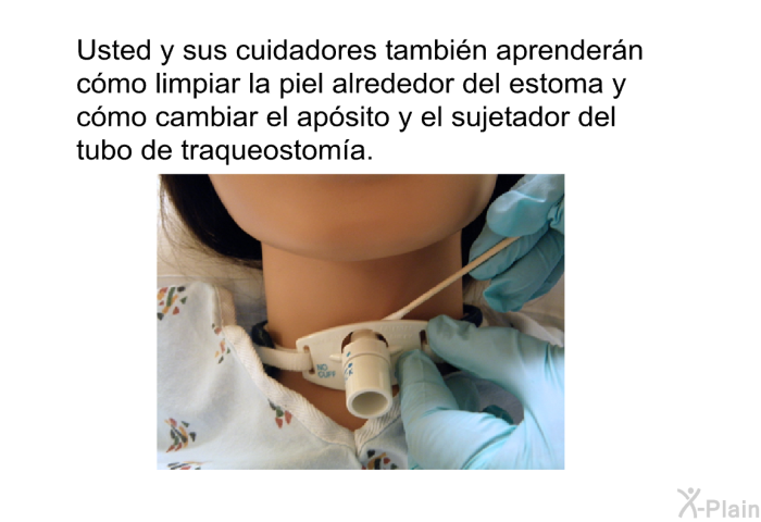 Usted y sus cuidadores tambi�n aprender�n c�mo limpiar la piel alrededor del estoma y c�mo cambiar el ap�sito y el sujetador del tubo de traqueostom�a.