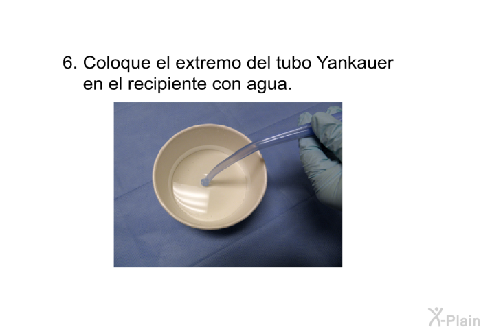 Coloque el extremo del tubo Yankauer en el recipiente con agua.