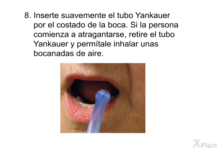 Inserte suavemente el tubo Yankauer por el costado de la boca. Si la persona comienza a atragantarse, retire el tubo Yankauer y perm�tale inhalar unas bocanadas de aire.