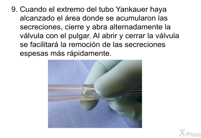 Cuando el extremo del tubo Yankauer haya alcanzado el �rea donde se acumularon las secreciones, cierre y abra alternadamente la v�lvula con el pulgar. Al abrir y cerrar la v�lvula se facilitar� la remoci�n de las secreciones espesas m�s r�pidamente.