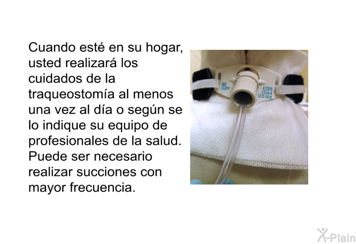 Cuando est� en su hogar, usted realizar� los cuidados de la traqueostom�a al menos una vez al d�a o seg�n se lo indique su equipo de profesionales de la salud. Puede ser necesario realizar succiones con mayor frecuencia.