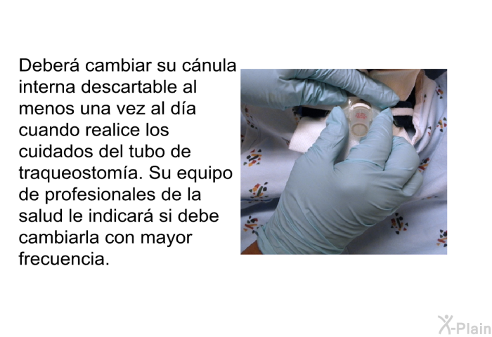 Deber� cambiar su c�nula interna descartable al menos una vez al d�a cuando realice los cuidados del tubo de traqueostom�a. Su equipo de profesionales de la salud le indicar� si debe cambiarla con mayor frecuencia.