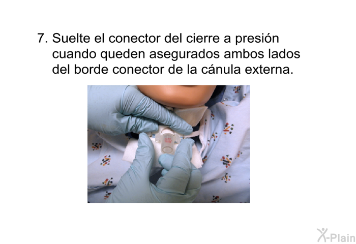 Suelte el conector del cierre a presi�n cuando queden asegurados ambos lados del borde conector de la c�nula externa.