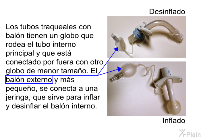 Los tubos traqueales con baln tienen un globo que rodea el tubo interno principal y que est conectado por fuera con otro globo de menor tamao. El baln externo y ms pequeo, se conecta a una jeringa, que sirve para inflar y desinflar el baln interno.