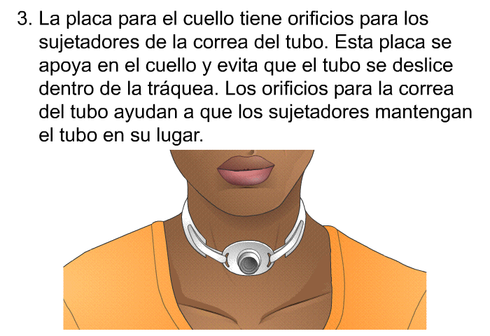 La placa para el cuello tiene orificios para los sujetadores de la correa del tubo. Esta placa se apoya en el cuello y evita que el tubo se deslice dentro de la tr�quea. Los orificios para la correa del tubo ayudan a que los sujetadores mantengan el tubo en su lugar.