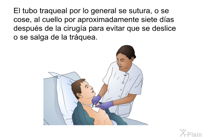 El tubo traqueal por lo general se sutura, o se cose, al cuello por aproximadamente siete d�as despu�s de la cirug�a para evitar que se deslice o se salga de la tr�quea.