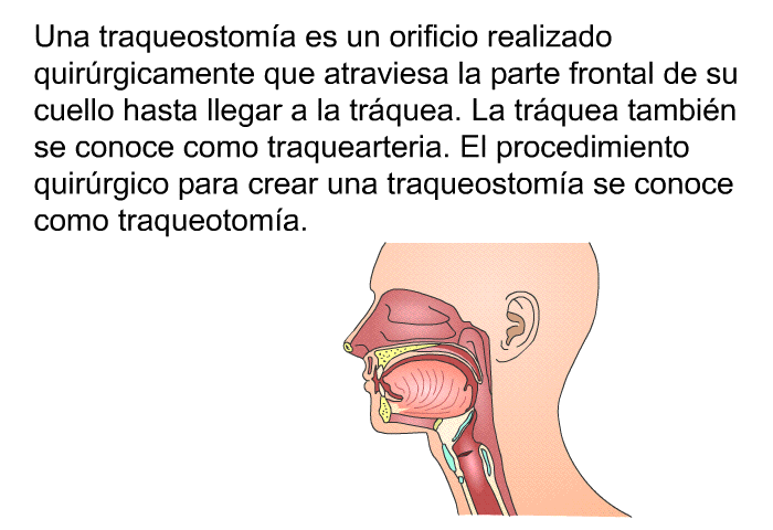 Una traqueostoma es un orificio realizado quirrgicamente que atraviesa la parte frontal de su cuello hasta llegar a la trquea. La trquea tambin se conoce como traquearteria. El procedimiento quirrgico para crear una traqueostoma se conoce como traqueotoma.
