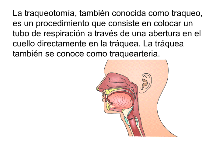 La traqueotoma, tambin conocida como traqueo, es un procedimiento que consiste en colocar un tubo de respiracin a travs de una abertura en el cuello directamente en la trquea. La trquea tambin se conoce como traquearteria.