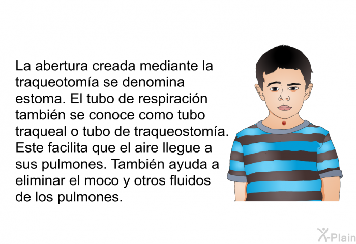 La abertura creada mediante la traqueotoma se denomina estoma. El tubo de respiracin tambin se conoce como tubo traqueal o tubo de traqueostoma. Este facilita que el aire llegue a sus pulmones. Tambin ayuda a eliminar el moco y otros fluidos de los pulmones.