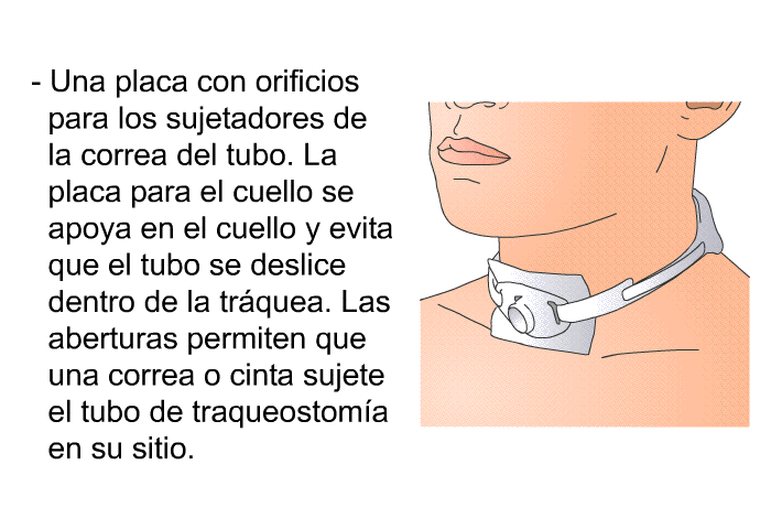 Una placa con orificios para los sujetadores de la correa del tubo. La placa para el cuello se apoya en el cuello y evita que el tubo se deslice dentro de la trquea. Las aberturas permiten que una correa o cinta sujete el tubo de traqueostoma en su sitio.