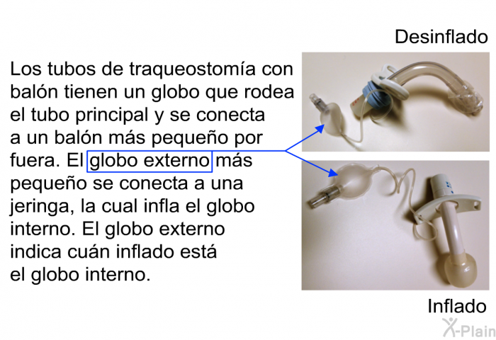 Los tubos de traqueostoma con baln tienen un globo que rodea el tubo principal y se conecta a un baln ms pequeo por fuera. El globo externo ms pequeo se conecta a una jeringa, la cual infla el globo interno. El globo externo indica cun inflado est el globo interno.