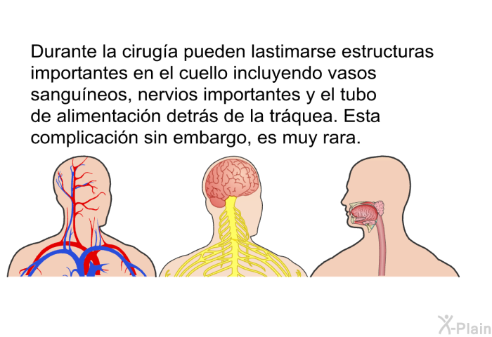Durante la ciruga pueden lastimarse estructuras importantes en el cuello incluyendo vasos sanguneos, nervios importantes y el tubo de alimentacin detrs de la trquea. Esta complicacin sin embargo, es muy rara.