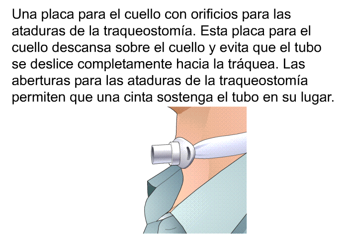 Una placa para el cuello con orificios para las ataduras de la traqueostoma. Esta placa para el cuello descansa sobre el cuello y evita que el tubo se deslice completamente hacia la trquea. Las aberturas para las ataduras de la traqueostoma permiten que una cinta sostenga el tubo en su lugar.