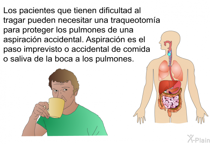 Los pacientes que tienen dificultad al tragar pueden necesitar una traqueotoma para proteger los pulmones de una aspiracin accidental. Aspiracin es el paso imprevisto o accidental de comida o saliva de la boca a los pulmones.