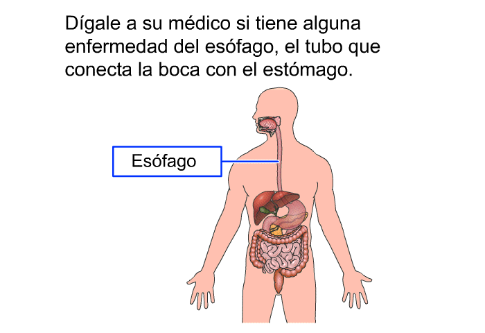 D�gale a su m�dico si tiene alguna enfermedad del es�fago, el tubo que conecta la boca con el est�mago.