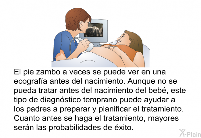 El pie zambo a veces se puede ver en una ecografa antes del nacimiento. Aunque no se pueda tratar antes del nacimiento del beb, este tipo de diagnstico temprano puede ayudar a los padres a preparar y planificar el tratamiento. Cuanto antes se haga el tratamiento, mayores sern las probabilidades de xito.