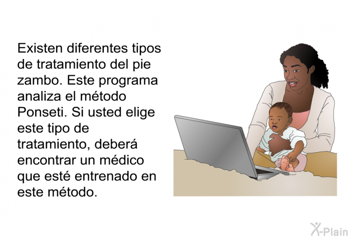 Existen diferentes tipos de tratamiento del pie zambo. Esta informacin acerca de su salud analiza el mtodo Ponseti. Si usted elige este tipo de tratamiento, deber encontrar un mdico que est entrenado en este mtodo.