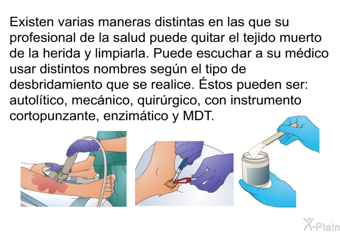 Existen varias maneras distintas en las que su profesional de la salud puede quitar el tejido muerto de la herida y limpiarla. Puede escuchar a su mdico usar distintos nombres segn el tipo de desbridamiento que se realice. Éstos pueden ser: autoltico, mecnico, quirrgico, con instrumento cortopunzante, enzimtico y MDT.