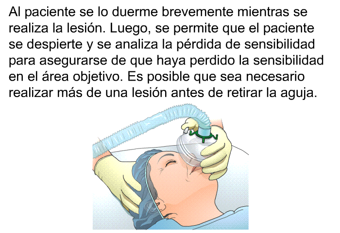 Al paciente se lo duerme brevemente mientras se realiza la lesin. Luego, se permite que el paciente se despierte y se analiza la prdida de sensibilidad para asegurarse de que haya perdido la sensibilidad en el rea objetivo. Es posible que sea necesario realizar ms de una lesin antes de retirar la aguja.