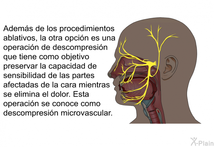Adems de los procedimientos ablativos, la otra opcin es una operacin de descompresin que tiene como objetivo preservar la capacidad de sensibilidad de las partes afectadas de la cara mientras se elimina el dolor. Esta operacin se conoce como descompresin microvascular.