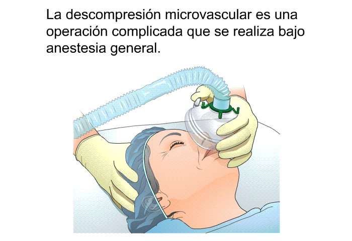 La descompresin microvascular es una operacin complicada que se realiza bajo anestesia general.