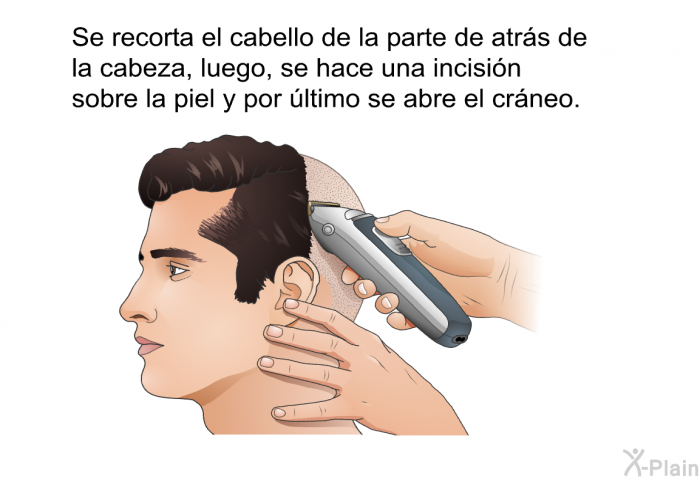 Se recorta el cabello de la parte de atrs de la cabeza, luego, se hace una incisin sobre la piel y por ltimo se abre el crneo.