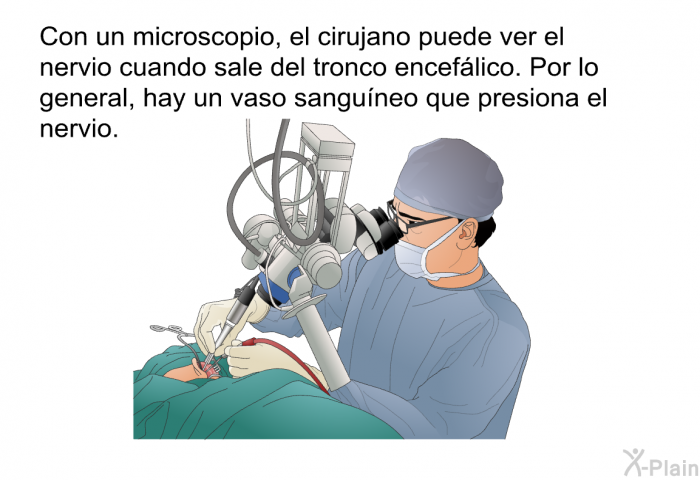 Con un microscopio, el cirujano puede ver el nervio cuando sale del tronco enceflico. Por lo general, hay un vaso sanguneo que presiona el nervio.