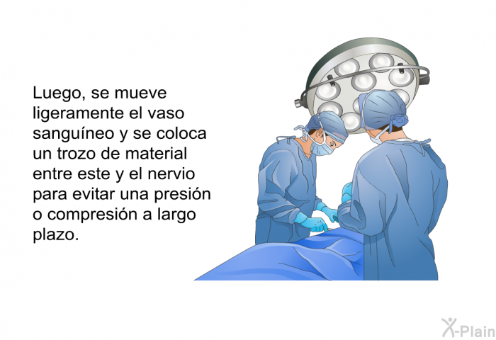 Luego, se mueve ligeramente el vaso sanguneo y se coloca un trozo de material entre este y el nervio para evitar una presin o compresin a largo plazo.